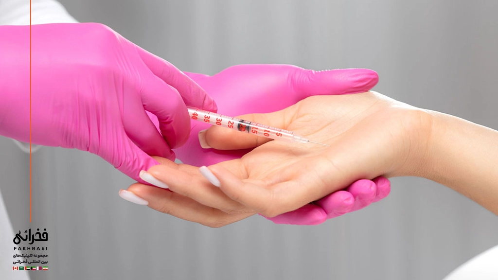 مراقبت‌های پس از تزریق بوتاکس به کف دست