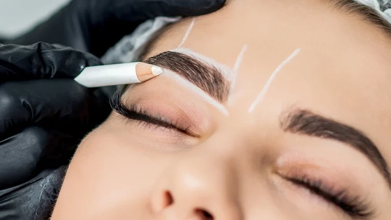 ریزش ابرو بعد از کاشت