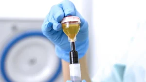 پی آر پی مو چند درصد جواب میده؟