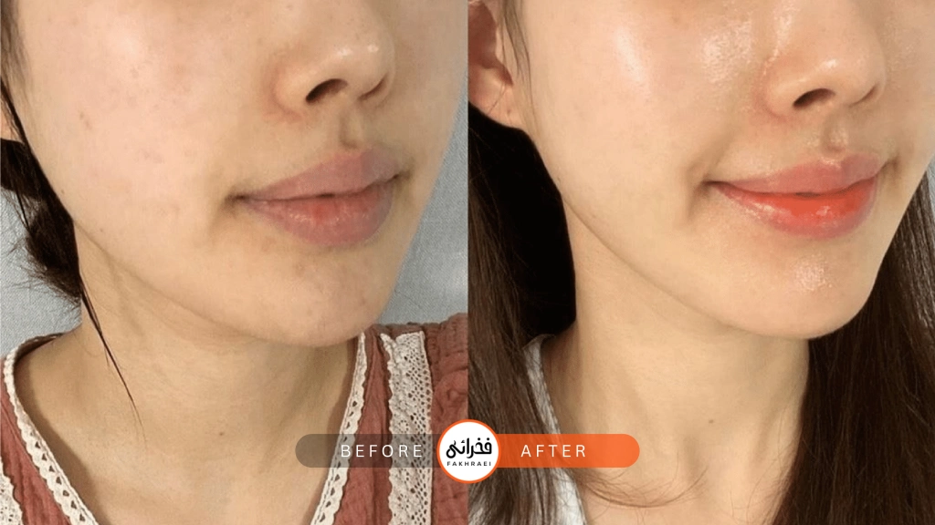 کاربرد اگزوزوم