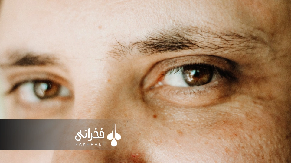 علت ریزش ابرو