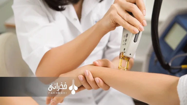 جلسات لیزر موهای زائد