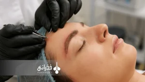 مراقبتهای بعد از کاشت ابرو