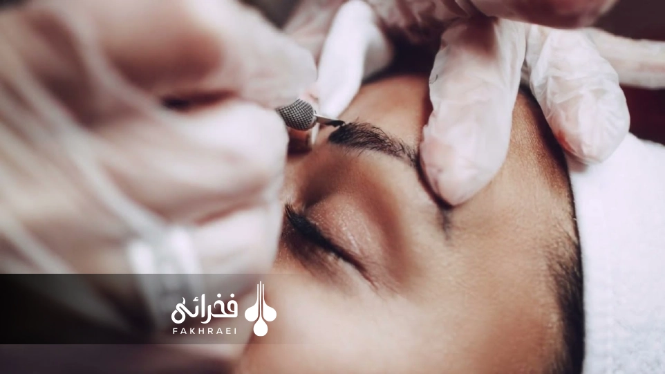 کاشت ابرو بهتر است یا میکروبلیدینگ؟