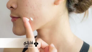 ازبین بردن لک صورت با خمیردندان