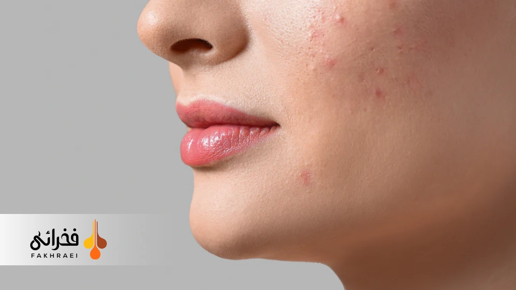 آیا از بین بردن لک صورت با خمیردندان امکان‌پذیر است؟