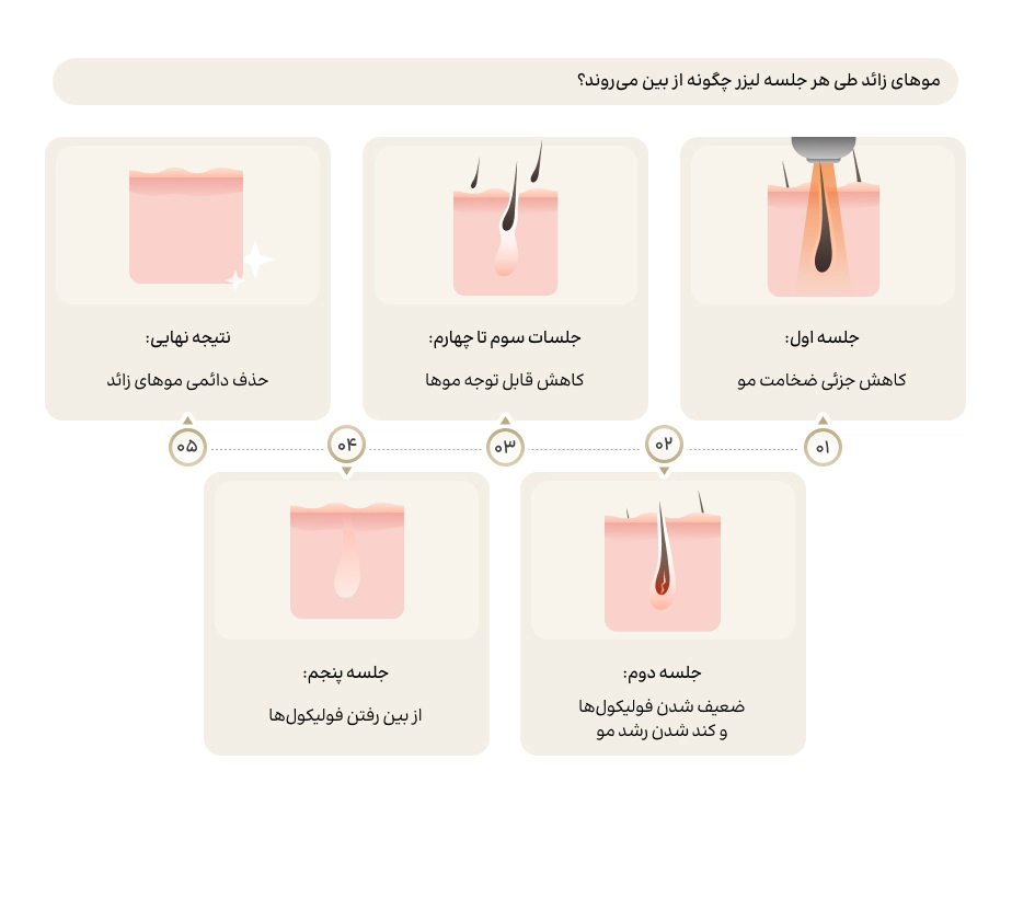 اینفوگرافیک نحوه از بین رفتن موهای زائد