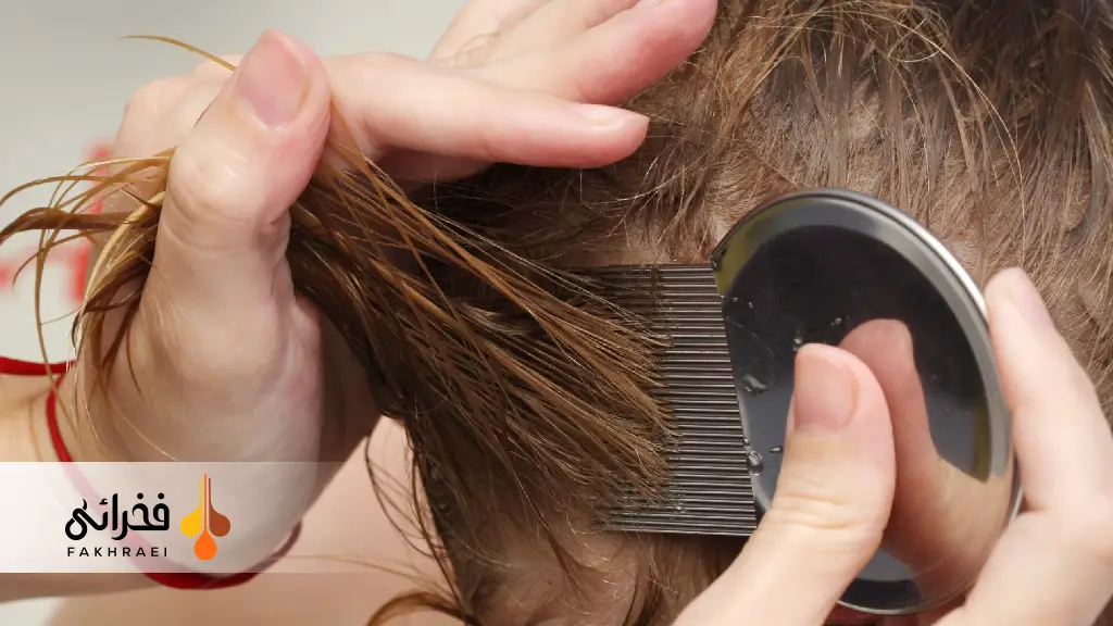 شانهکشی مرطوب برای درمان شپش سر