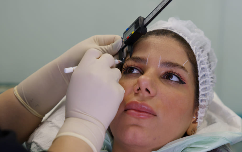 مراحل کاشت ابرو