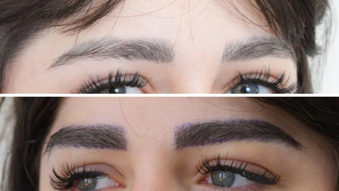 تصویر نمونه قبل و بعد کاشت ابرو