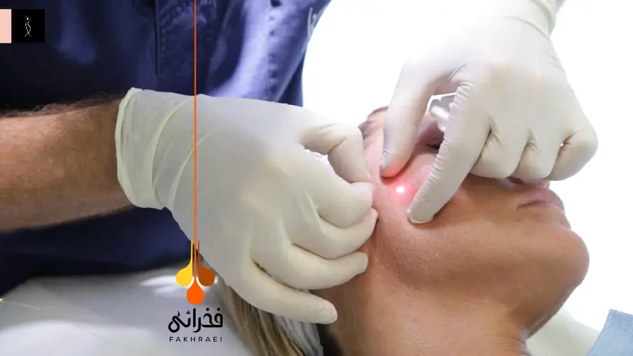 اندولیفت چیست