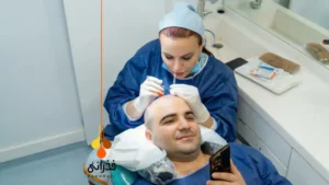 بهترین دکتر کاشت مو در ایران