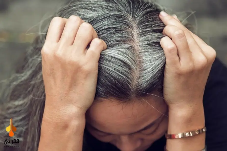 علت سفید شدن مو